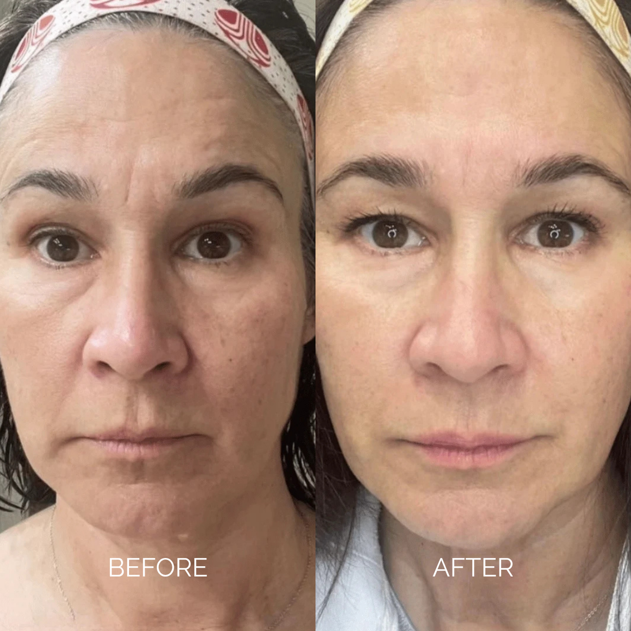 Antiage Cream | Sodium DNA