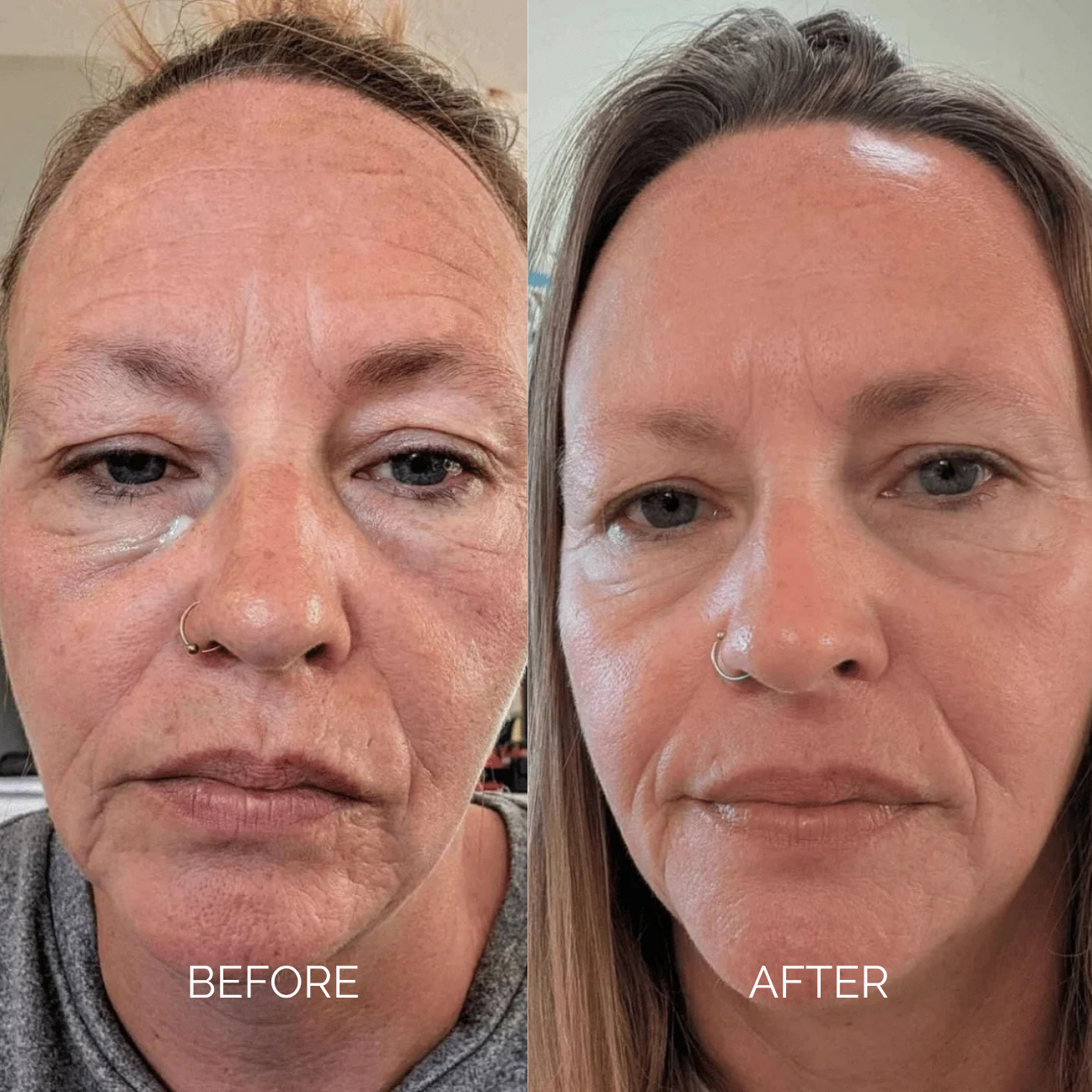 Antiage Cream | Sodium DNA