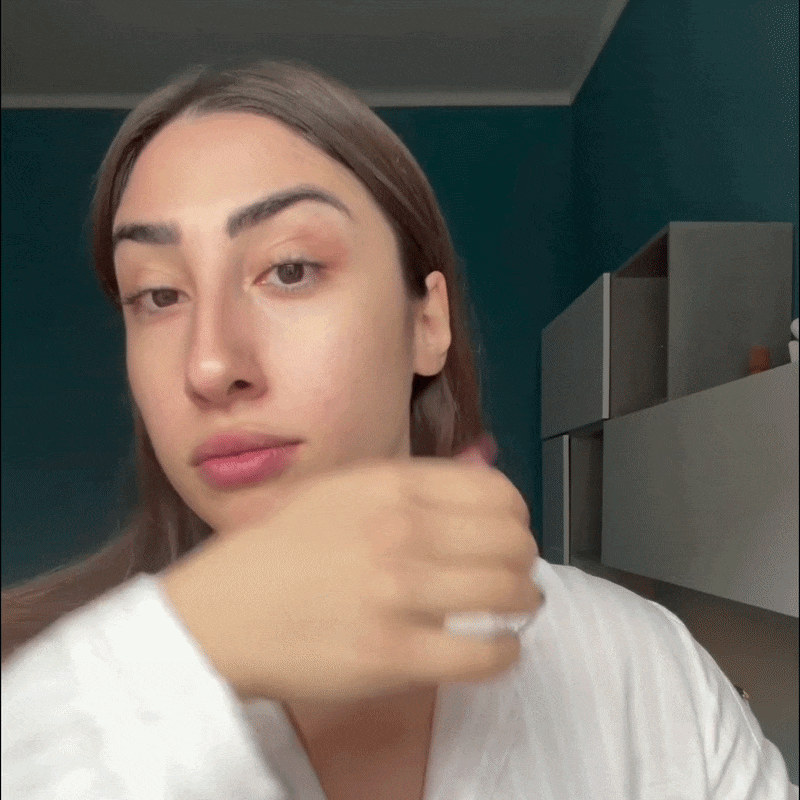 Acne Journey