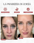 Maschera Rigenerante al PDRN