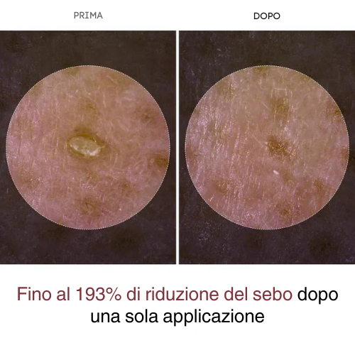 Aurea Duo Siero Esfoliante al Riso