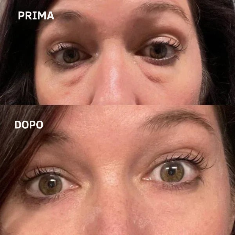 Leviga, rassoda e rimpolpa le zone più difficili con i patch mirati ai Peptidi Aurea