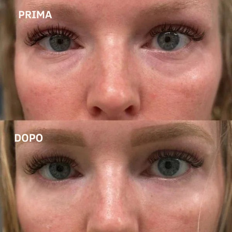 Leviga, rassoda e rimpolpa le zone più difficili con i patch mirati ai Peptidi Aurea