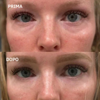 Leviga, rassoda e rimpolpa le zone più difficili con i patch mirati ai Peptidi Aurea