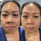 Leviga, rassoda e rimpolpa le zone più difficili con i patch mirati ai Peptidi Aurea