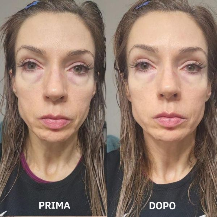 Leviga, rassoda e rimpolpa le zone più difficili con i patch mirati ai Peptidi Aurea