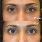 Leviga, rassoda e rimpolpa le zone più difficili con i patch mirati ai Peptidi Aurea