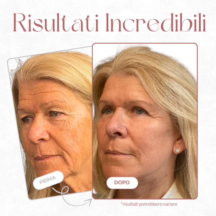 Auréa Stick Balsamo Rimpolpante al Calcio - Per Rughe e Imperfezioni