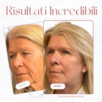 Auréa Stick Balsamo Rimpolpante al Calcio - Per Rughe e Imperfezioni