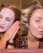 Maschera Rigenerante al PDRN