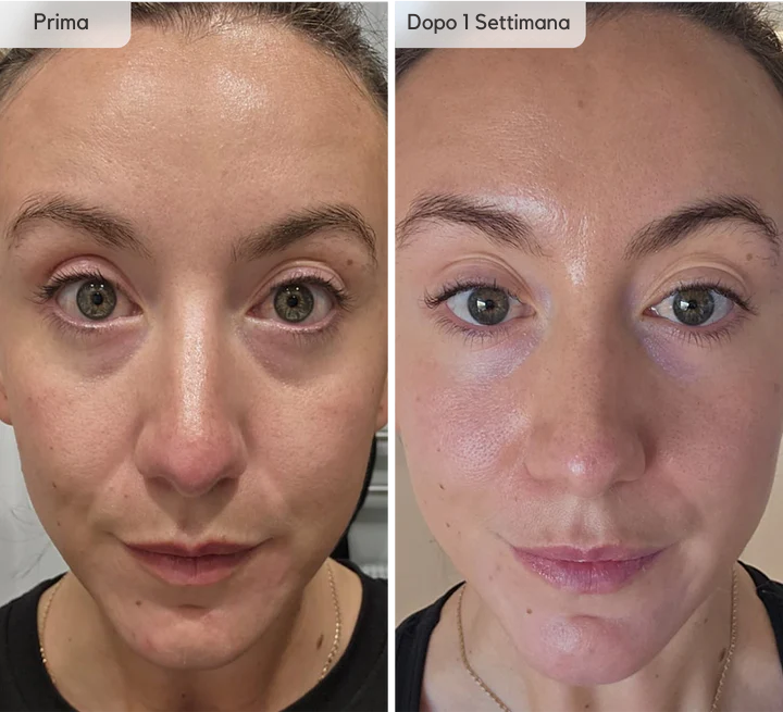 Leviga, rassoda e rimpolpa le zone più difficili con i patch mirati ai Peptidi Aurea