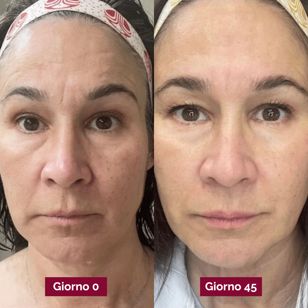 Crema Rigenerante PDRN
